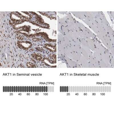 Immunohistochemistry-Paraffin: AKT1 Antibody [NBP1-89159]