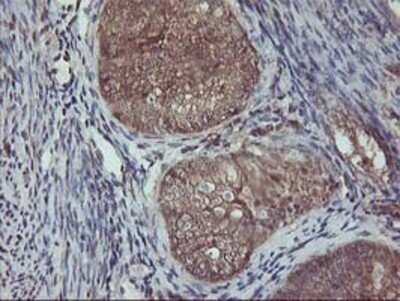 Immunohistochemistry: AKT1 Antibody (OTI4D6) - Azide and BSA Free [NBP2-70135]
