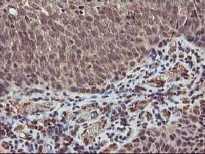 Immunohistochemistry: AKT1 Antibody (OTI4D6) - Azide and BSA Free [NBP2-70135]