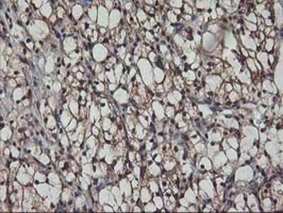 Immunohistochemistry: AKT1 Antibody (OTI4D6) - Azide and BSA Free [NBP2-70135]
