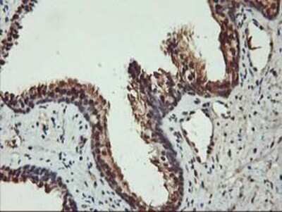 Immunohistochemistry: AKT1 Antibody (OTI4D6) - Azide and BSA Free [NBP2-70135]