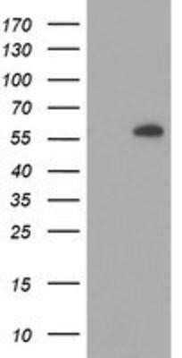 Western Blot: AKT1 Antibody (OTI4D6)Azide and BSA Free [NBP2-70135]