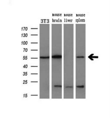 Western Blot: AKT1 Antibody (OTI4D6)Azide and BSA Free [NBP2-70135]