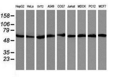 Western Blot: AKT1 Antibody (OTI4D6)Azide and BSA Free [NBP2-70135]