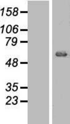 Western Blot: AKT1 Overexpression Lysate [NBL1-07441]