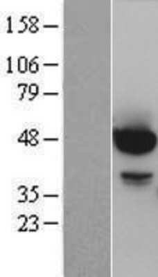 Western Blot: AKT1 Overexpression Lysate [NBP2-04280]