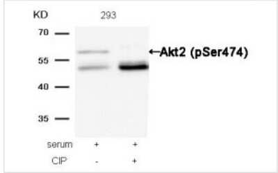 Western Blot: AKT2 [p Ser474] Antibody [NB100-81780]