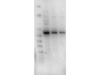 Western Blot: AKT2 Antibody (11F6.B2) [NBP2-44216]