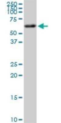 Western Blot: AKT2 Antibody (1D9) [H00000208-M03]