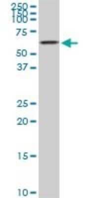 Western Blot: AKT2 Antibody (1D9) [H00000208-M03]