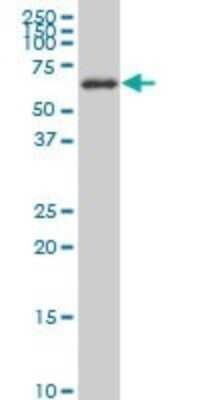 Western Blot: AKT2 Antibody (1D9) [H00000208-M03]