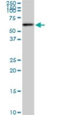 Western Blot: AKT2 Antibody (1D9) [H00000208-M03]