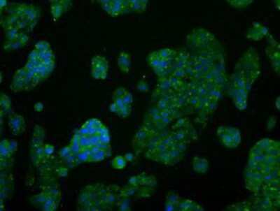 Immunocytochemistry/ Immunofluorescence: AKT2 Antibody (OTI4H7) [NBP2-02231]