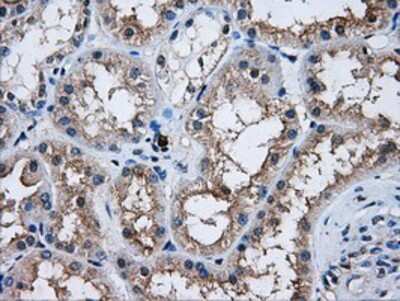 Immunohistochemistry-Paraffin: AKT2 Antibody (OTI4H7) [NBP2-02231]