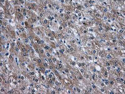 Immunohistochemistry-Paraffin: AKT2 Antibody (OTI4H7) [NBP2-02231]