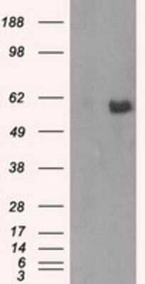 Western Blot: AKT2 Antibody (OTI4H7) [NBP2-02231]