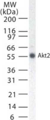 Western Blot: AKT2 Antibody (95C657.1.2) [NB100-56676]