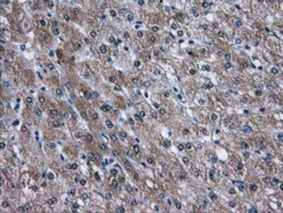 Immunohistochemistry: AKT2 Antibody (OTI4H7) - Azide and BSA Free [NBP2-70146]