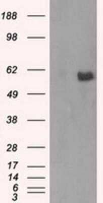 Western Blot: AKT2 Antibody (OTI4H7)Azide and BSA Free [NBP2-70146]