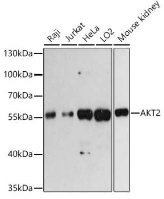 Western Blot: AKT2 AntibodyAzide and BSA Free [NBP3-05341]