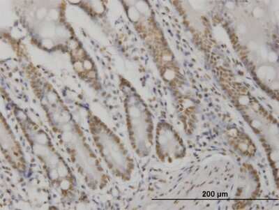 Immunohistochemistry-Paraffin: AKT2 Antibody (X1) [H00000208-M06]
