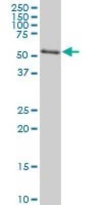 Western Blot: AKT2 Antibody (X1) [H00000208-M06]