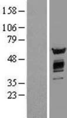 Western Blot: AKT2 Overexpression Lysate [NBL1-07442]