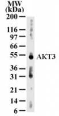 Western Blot: AKT3 Antibody (66C1247) [NB600-1298]