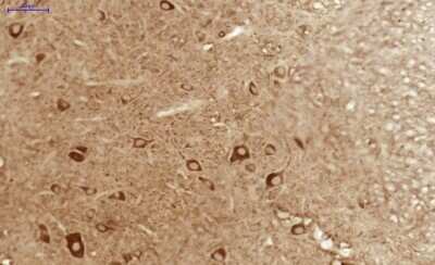 Immunohistochemistry: AKT3 Antibody [NBP1-80900]