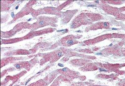 Immunohistochemistry-Paraffin: AKT3 Antibody [NB100-1480]