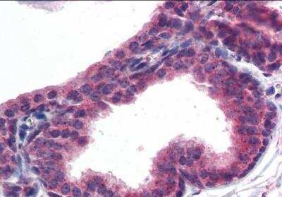 Immunohistochemistry-Paraffin: AKT3 Antibody [NB100-1480]