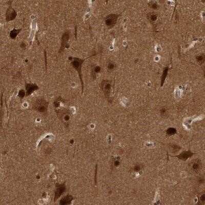 Immunohistochemistry-Paraffin: AKT3 Antibody [NBP1-80900]