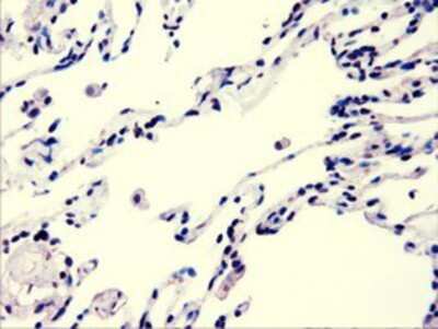 Immunohistochemistry: AKT3 Antibody (OTI9B2) - Azide and BSA Free [NBP2-71528]