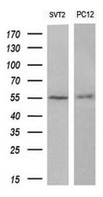 Western Blot: AKT3 Antibody (OTI9B2)Azide and BSA Free [NBP2-71528]