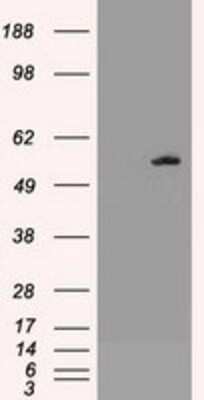 Western Blot: AKT3 Antibody (OTI9B2)Azide and BSA Free [NBP2-71528]