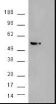 Western Blot: AKT3 Antibody [NB100-1480]