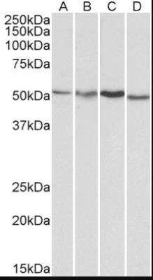 Western Blot: AKT3 Antibody [NB100-1480]