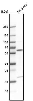 Western Blot: AKT3 Antibody [NBP1-80900]