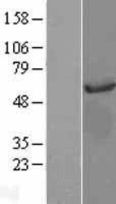 Western Blot: AKT3 Overexpression Lysate [NBL1-07443]