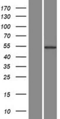 Western Blot: AKT3 Overexpression Lysate [NBL1-07444]