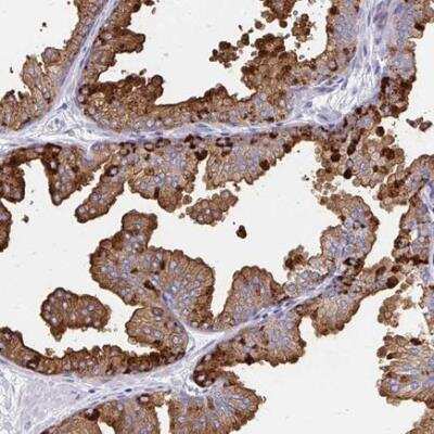 Immunohistochemistry: TEKT4 Antibody [NBP2-46820]