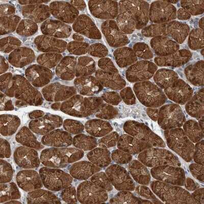 Immunohistochemistry-Paraffin: ALAD Antibody [NBP1-89157]