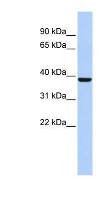 Western Blot: ALAD Antibody [NBP1-56506]