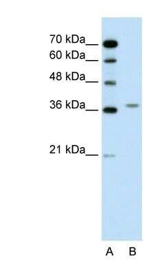 Western Blot: ALAD Antibody [NBP1-56507]