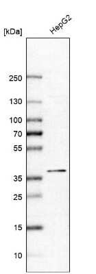 Western Blot: ALAD Antibody [NBP1-89157]