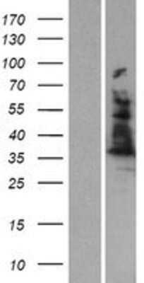 Western Blot: ALAD Overexpression Lysate [NBP2-09063]