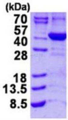 SDS-PAGE: Recombinant Human ALAD His Protein [NBP1-99075]