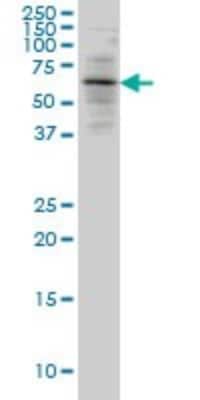 Western Blot: ALAS2 Antibody (6C1) [H00000212-M01]