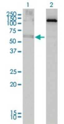 Western Blot: ALAS2 Antibody (6C1) [H00000212-M01]