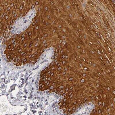 Immunohistochemistry-Paraffin: ALAS2 Antibody [NBP1-89008]